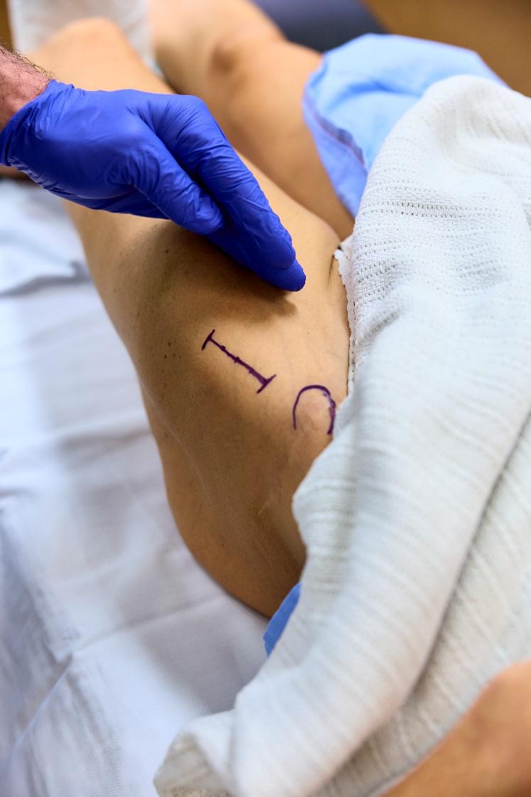 Hip replacement surgery